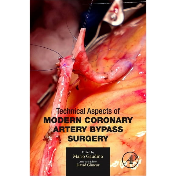 Technical Aspects of Modern Coronary Artery Bypass Surgery, (Paperback)