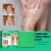Varicose-Veins Treatment Soap Dredge Relieve Varicose Leg Bulge Earthworm Legs