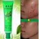thumbnail image 5 of 30g Cuidado de la piel facial Control de aceite del acné Productos para el acné Belleza facial, 5 of 8