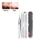 thumbnail image 5 of Xihbxyly Kit de Eliminación de Puntos Negros, Extractores Profesionales de Acero Inoxidable, Mango Antideslizante, Estuche Portátil, Rutina de Cuidado de La Piel, Artículos Esenciales de Belleza para, 5 of 6