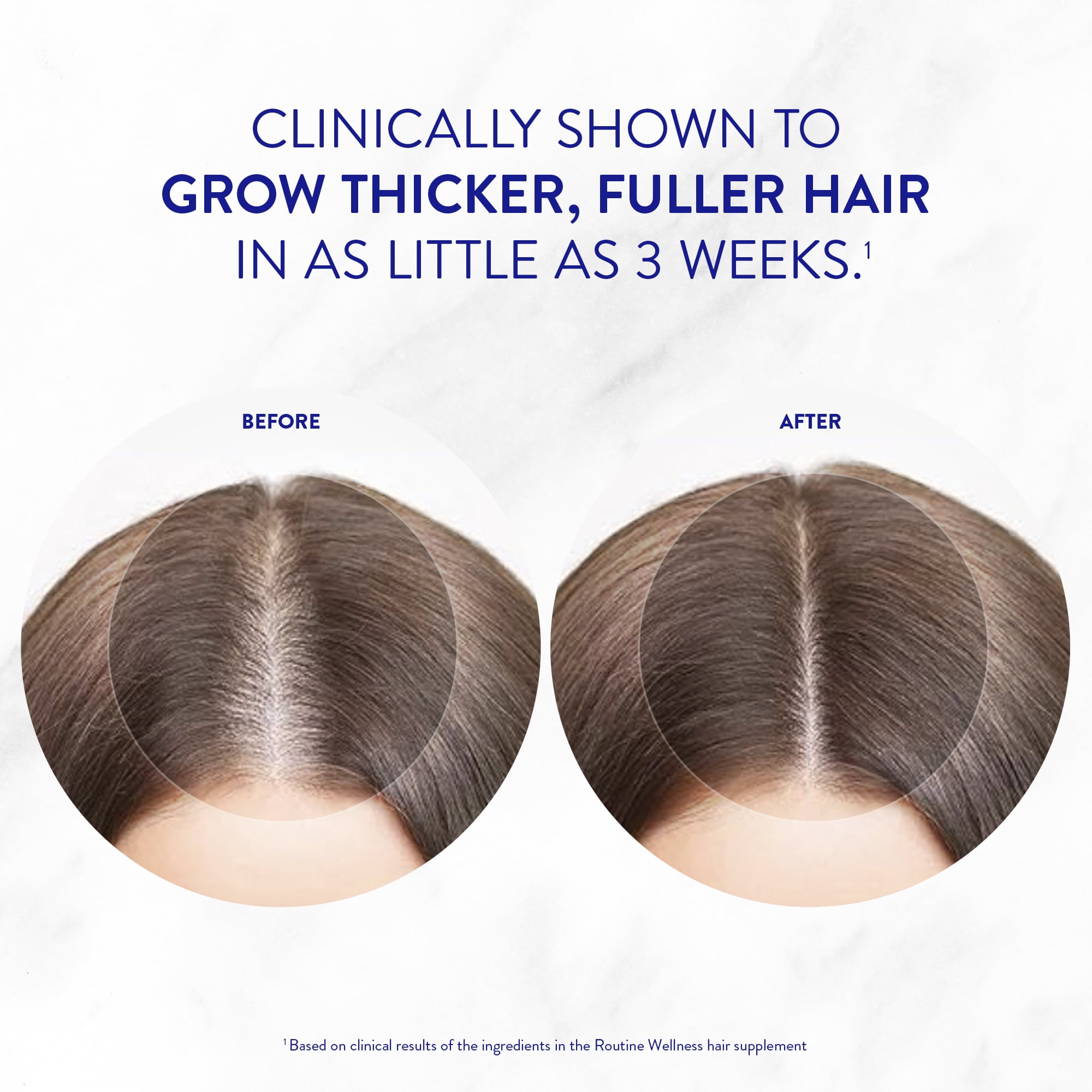 Routine Wellness Hair Growth Supplement - Clinically Tested for Thicker, Fuller Hair - Reduces Wrinkles, Fine Lines - Gluten Free, Ideal for Women & Men with Thinning Hair - 1 Bottle, 30 Day Supply