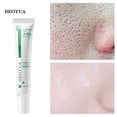 thumbnail image 1 of Crema facial con ácido salicílico Fivean eelhoe 20g Tratamiento para el acné, 1 of 1