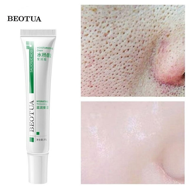 Crema facial con ácido salicílico Fivean eelhoe 20g Tratamiento para el acné