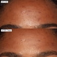 thumbnail image 4 of Sérum facial Sunday Riley Good Genes con ácido láctico todo en uno, 4 of 6