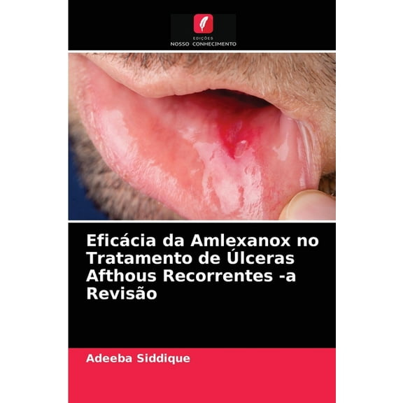 EficÃ¡cia da Amlexanox no Tratamento de Ãlceras Afthous Recorrentes -a RevisÃ£o, (Paperback)