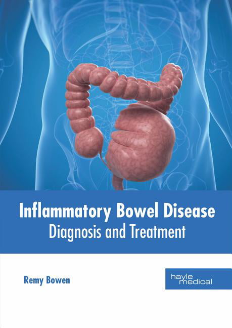 Inflammatory Bowel Disease Diagnosis And Treatment
