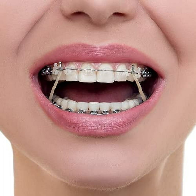 Dental Orthodontic Rubber Bands Ortho Elastics Latex Braces 5 Sizes for  3.5Oz