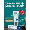 Medical Grade Silicone Scar Gel From C Section Stretch Marks Keloids medical-grade-silicone-scar-gel-from-c-section-stretch-marks-keloids