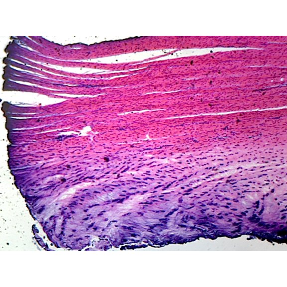 White Fibrocartilage from Intervertebral Disc, Mammalian; Section by Go Science Crazy
