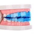 thumbnail image 5 of 2pcs Children Dental Tooth Orthodontic Appliance Trainer Kids Alignment Braces, 5 of 5