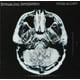 thumbnail image 2 of CD Hollywood Records Dear Agony, 2 of 2
