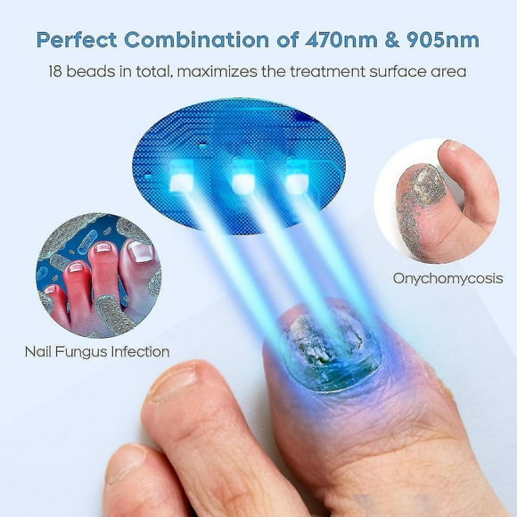 Nail Fungus Laser Treatment Device For Multiple Toenail, Home Use 905nm Infrared Light + 470nm Blue Light Toe Nail Fungus Device Jp