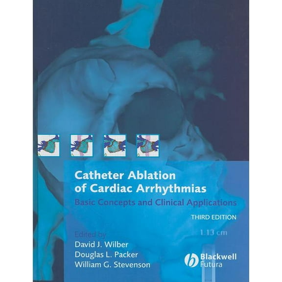 Catheter Ablation of Cardiac Arrhythmias, (Hardcover)