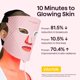 thumbnail image 2 of Máscara facial LED wavytalk de terapia con luz roja – Rosa, 2 of 9