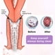 thumbnail image 4 of Sistema De Limpieza Vaginal, Ducha Vaginal Para Mujeres De 300 ML, Limpieza De 360 ​​​​grados Para Mujeres Embarazadas Para Enfermedades Ginecológicas, 4 of 7
