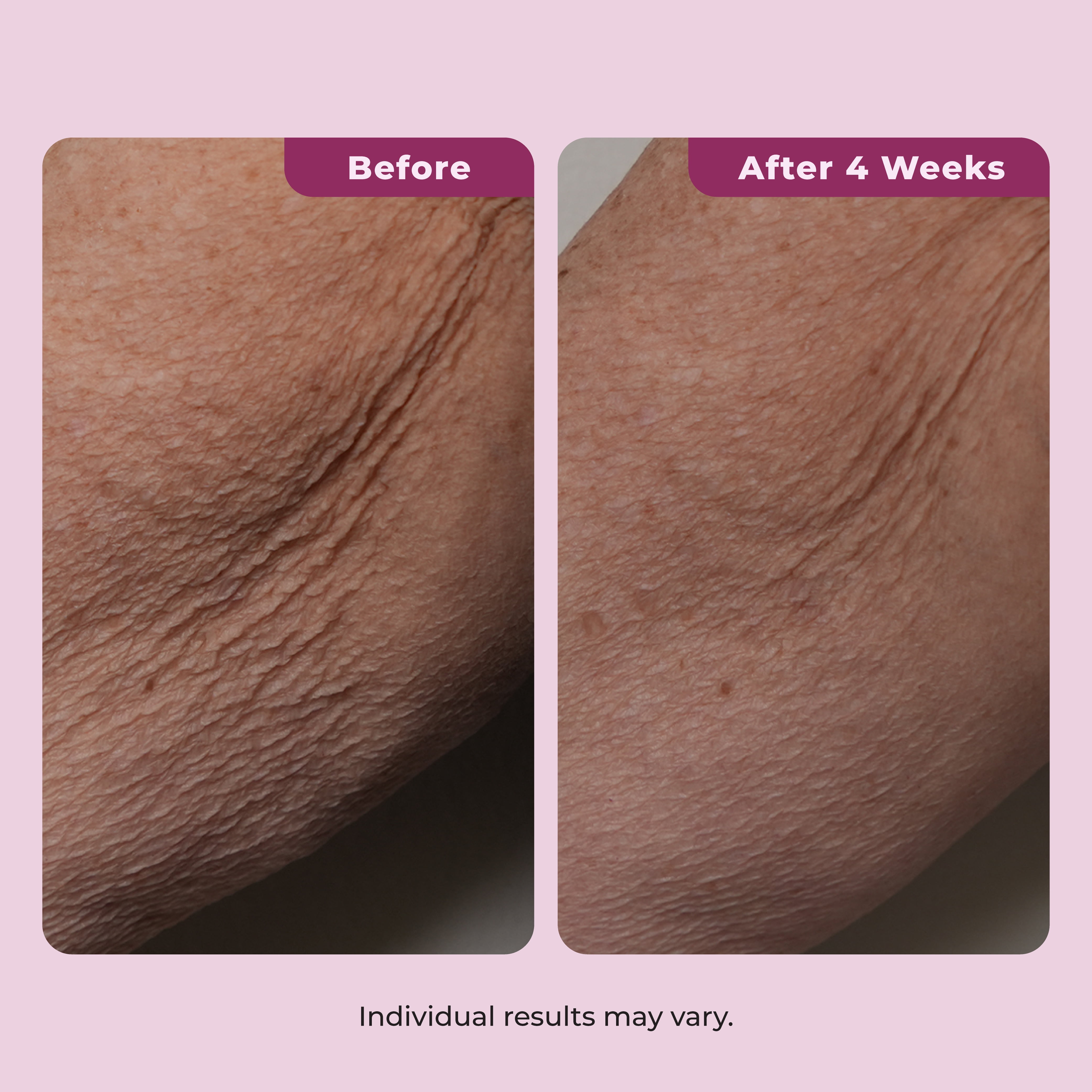 Dekliderm Neck Firming Cream for Neck, Chest & Arms – Tightening and Smoothing Cream for Crepey Skin, Wrinkles & Sagging Appearance