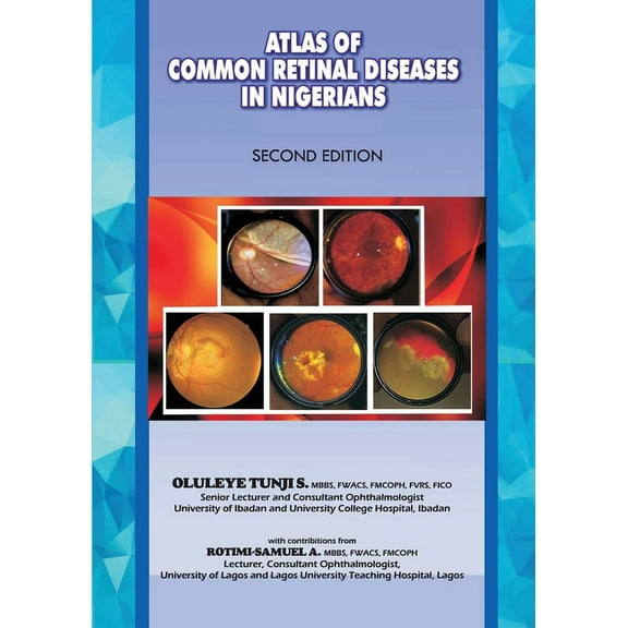 The Atlas of Retinal Diseases in Nigerians, (Paperback)