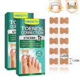 thumbnail image 1 of 100 piezas de pegatinas correctoras de uñas, parche corrector de uñas encarnadas, resistente al agua, tratamiento de paroniquia, herramienta de pedicura correctora de recuperación, 1 of 5