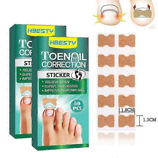 100 piezas de pegatinas correctoras de uñas, parche corrector de uñas encarnadas, resistente al agua, tratamiento de paroniquia, herramienta de pedicura correctora de recuperación