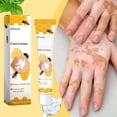 thumbnail image 2 of 20g VitiGO Bee Treatment Cream - 50% OFF, 2 of 8