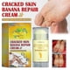 thumbnail image 2 of Jaysuing Foot Repair Cream Treatment Repair Cream Hydrating Anti-nourishing Skin Cracked Dry Itchy Feet |, 2 of 3