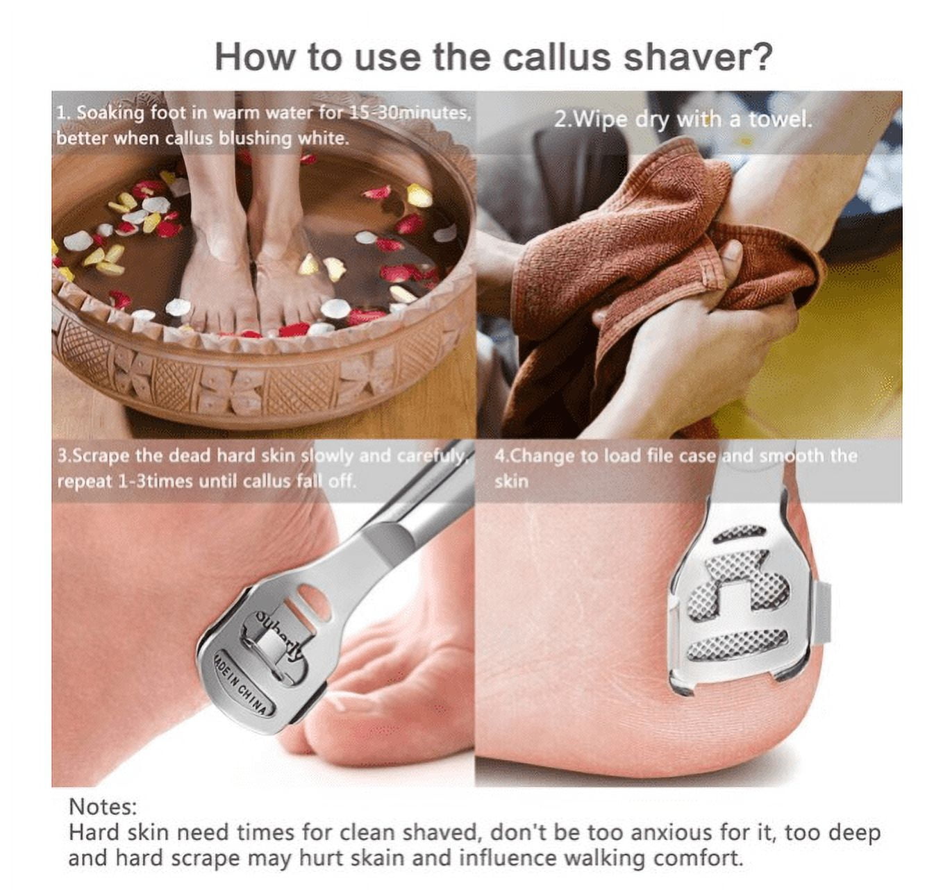 Callus Shaver, Callus Remover for Feet, Heel Hard Skin, Corn Callous  Removers Scraper - Yahoo Shopping