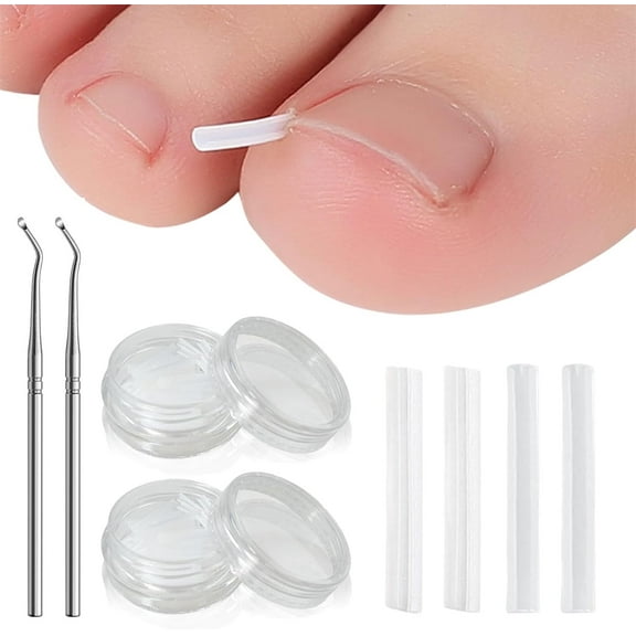 Ingrown Toenail Corrector Set,Beixkou (100 2) Ingrown Toenail Removal Kit,100 Pcs Pain-Free Toenail Straightener Strips with 2 Pcs Toenail Lifter,Easy Use Ingrown Toenail Tools Kit