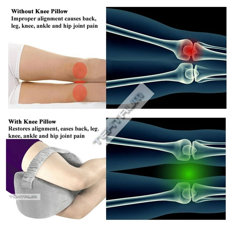 Tektrum Orthopedic Knee Pillow for Sciatica Relief, Back Pain, Leg Pain,  Hip pain, Joint Pain, Pregnancy, Spine Alignment - Memory Foam Wedge  Contour