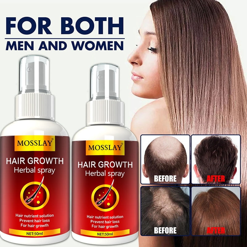Hair Growth Serum Spray Fast Hair Liquid Treatment Growth Scalp Hair  Follicle Anti Hair Loss Hair Care 