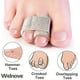 thumbnail image 3 of 6-pack Of Hammer Toe Straighteners For Straightening Hammer Toes, Broken Toes, Crooked Toes And Overlapping Toes, 3 of 3