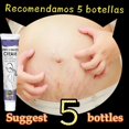 thumbnail image 5 of Crema para eliminar las marcas de estiramiento, Gel para el cuidado de la piel posparto del embarazo, color rojo y blanco antiguo, 5 of 5