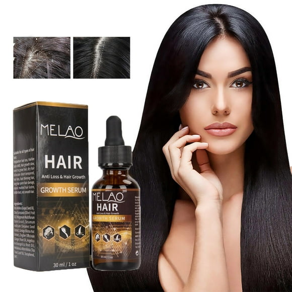 Xihbxyly Rizador de Pestañas Térmico, Calentamiento Rápido En 8 Segundos, Rizos Duraderos Durante 24 Horas, Recargable Por Usb y Portátil, Uso Personal, para Amantes Del Maquillaje, Peine de Segurida