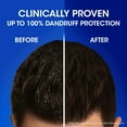 thumbnail image 3 of Head & Shoulders Cool Menthol Anti Dandruff Shampoo, 300 ml, 3 of 7