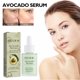 thumbnail image 4 of Teissuly Moisturizing Skin Moisturizing Brightening Facial Complexion Lightening Serum 30ml Teissuly WER202401272292, 4 of 9