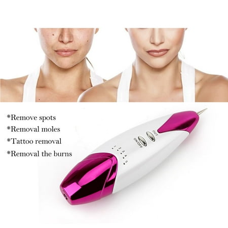 Laser Freckle Dark Spot Removal Pen Machine Skin Mole Wart Tag Removal With Needles, Pen Machine,Spot Removal (Best Skin Tag Removal Medicine)