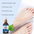 thumbnail image 2 of SharkTRUE 30ml Ingrown Toenail Treatment Drops - Natural Correction Best Cuticle Oils, 2 of 8