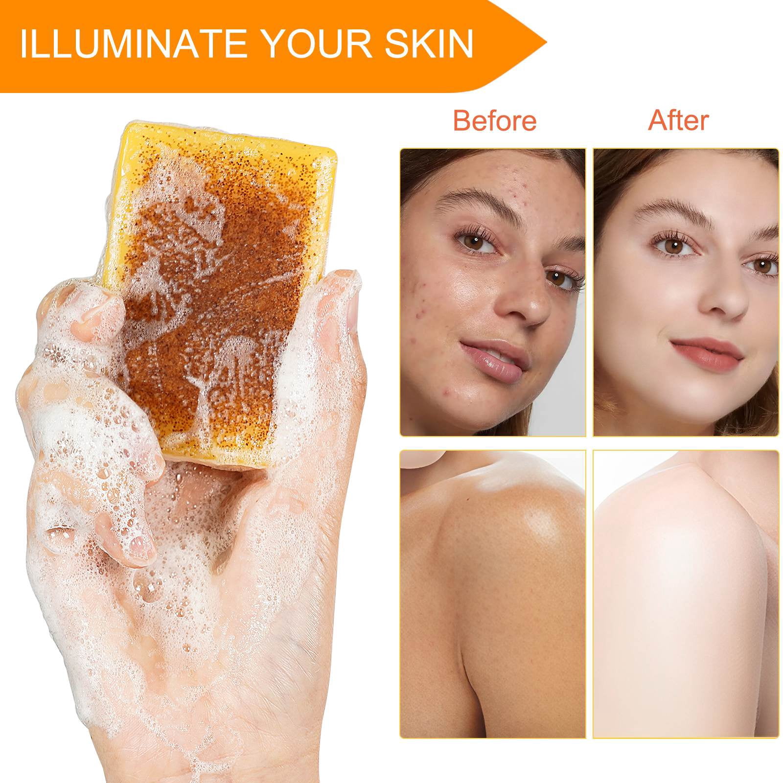 3PCS ikzee Kojic Acid Lemon Turmeric Soap for Face and Skin, Acne Scar - Dead Skin - Deep Cleansing - Refreshing (Foam Net Included)