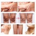 thumbnail image 2 of Crema blanqueadora para las partes íntimas del muslo, suero blanqueador para las axilas, ilumina los glúteos y las rodillas, elimina la melanina y la oscuridad, 2 of 3