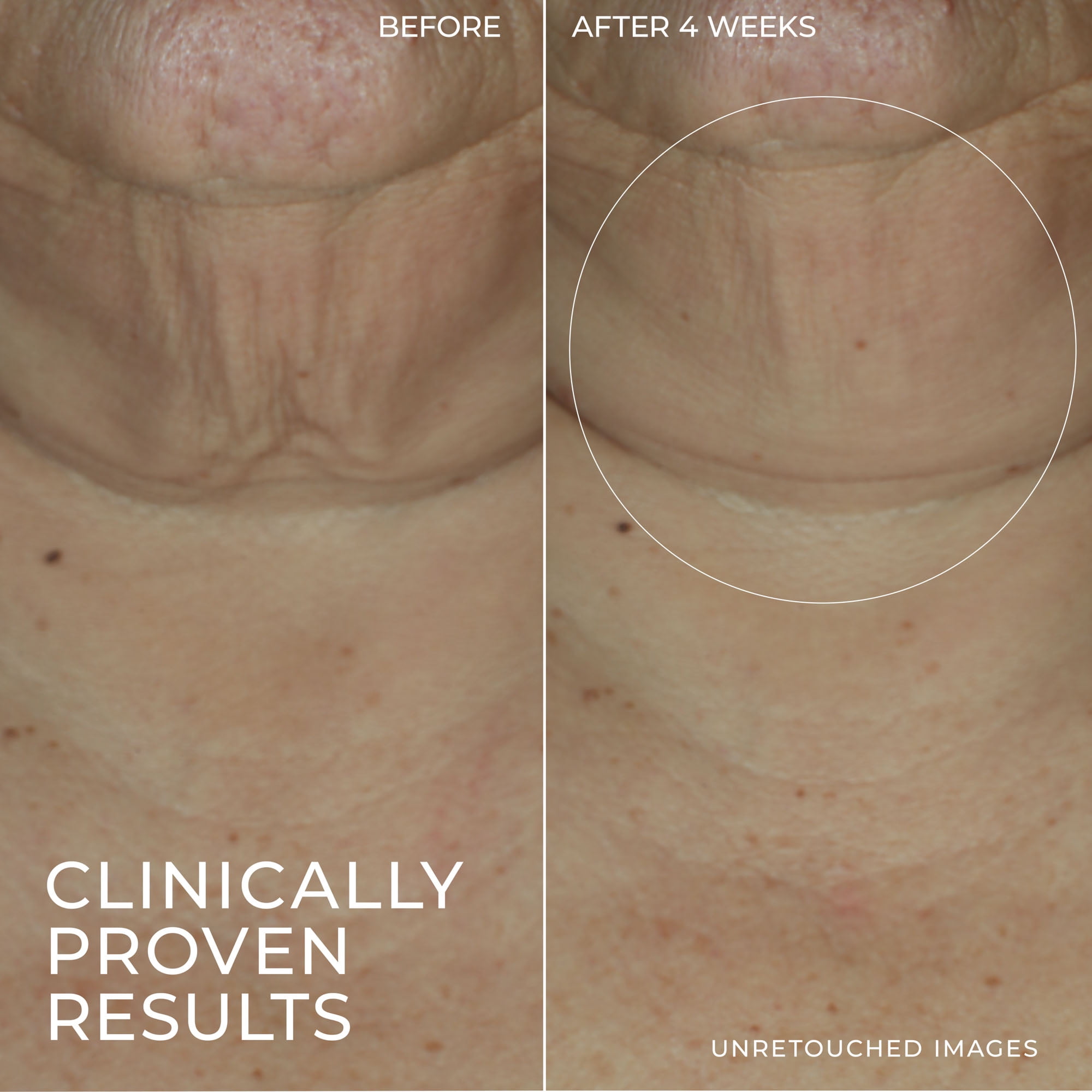 RoC Skincare - Derm Correxion®️ - Firming Serum Stick