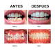 thumbnail image 3 of Retenedor De Dientes Para Corrección De Sonrisa 3 Etapas, 3 of 6