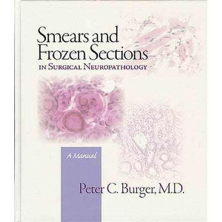 Smears and Frozen Sections in Surgical Neuropathology : A