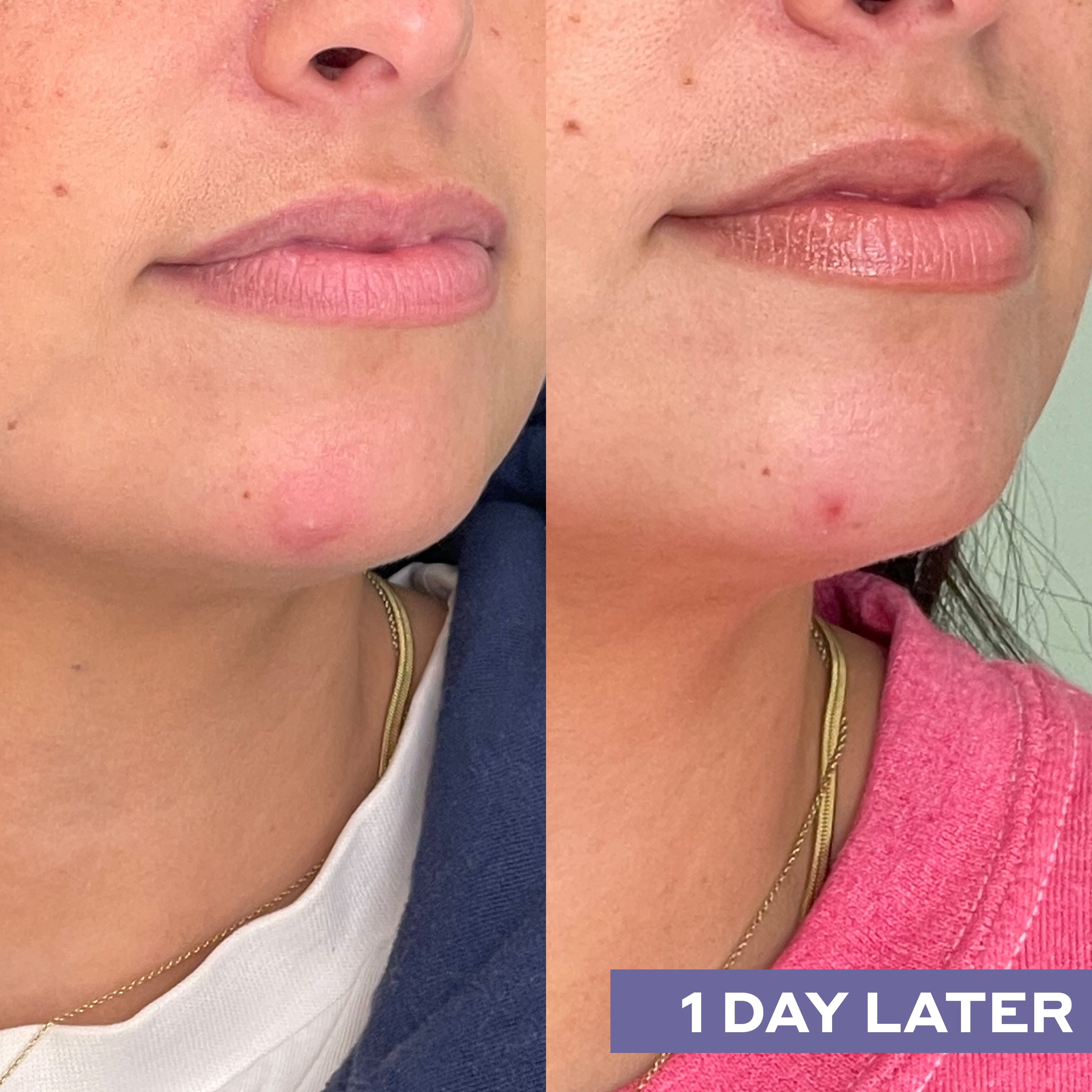 Mario Badescu Repairing Facial Spray With Hypochlorous Acid