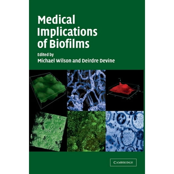 Medical Implications of Biofilms, (Paperback)