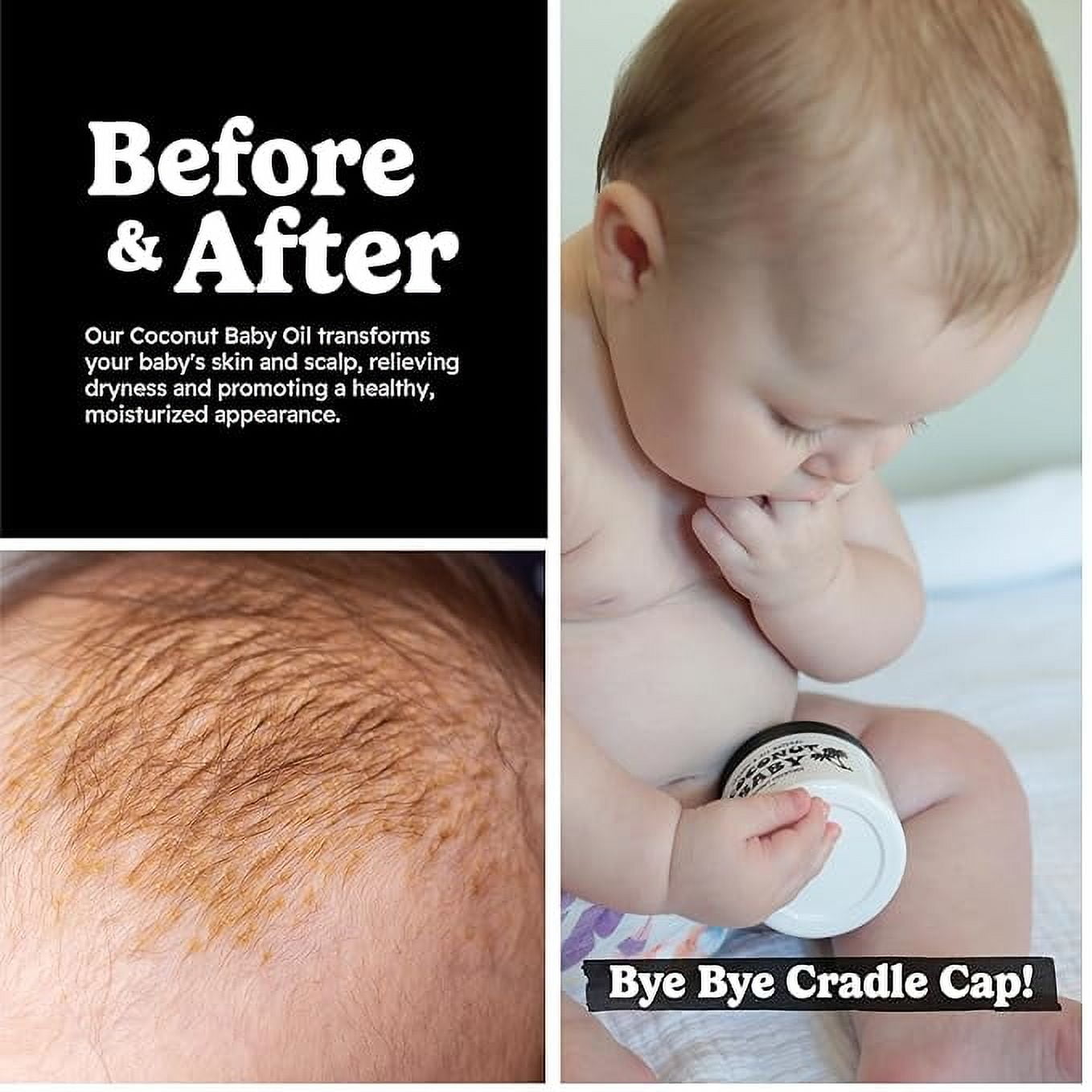 COCONUT BABY Hair Skin oil - Organic Moisturizer - Cradle Cap Treatment, Eczema & Psoriasis Relief, Massage, Sensitive Skin, Diaper Rash, Stretch Marks, with Sunflower & Grape Seed oils