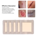 thumbnail image 4 of 5 Pieces Silicone Gel Wound Healing Patch Wound Protector Self Adhesive Waterproof Silicone Scar, 4 of 8