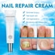 thumbnail image 1 of 20g Crema Para Uñas Con Hongos Crema Para Uñas Anti Hongos Para Uñas ANGGREK Fungus Nail Cream, 1 of 8