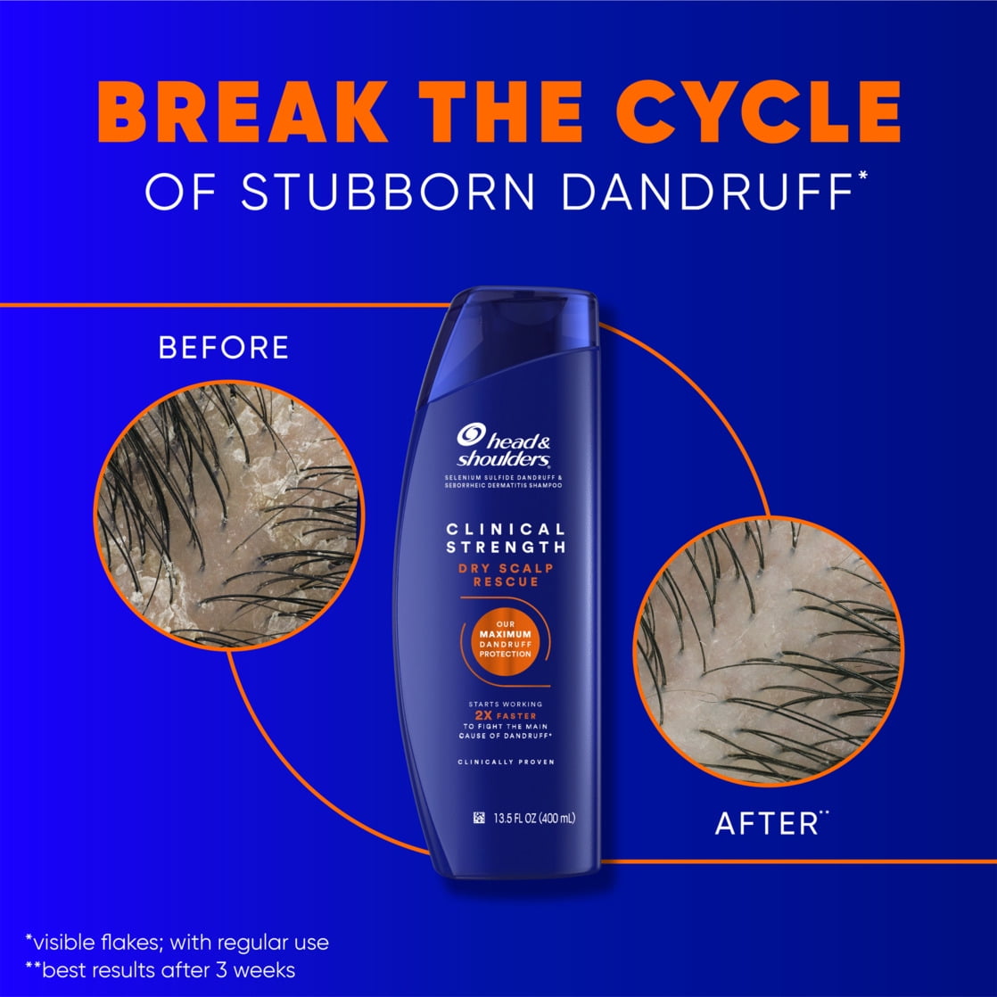 Head Champú para la Caspa y Hombros Clinical Strength, Rescate Del Cuero Cabelludo Seco, 13.5 fl oz