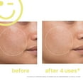 thumbnail image 5 of Kate Somerville MEGA-C 30% Vitamin C Brightening Facial, 2 Fl Oz, 5 of 5