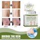 thumbnail image 5 of Crema reparadora de venas, masajea las piernas para aliviar el dolor, draga los meridianos, dilata las venas, cuida y repara la crema Kaili Sencillez, 5 of 5