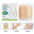 Silicone Scar Stickers Medical Silicone EasyTear Gel Tape Roll Medical